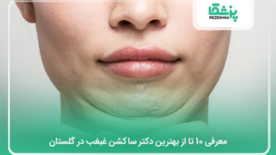 بهترین دکتر ساکشن غبغب در گلستان