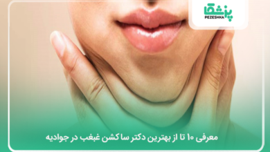بهترین دکتر ساکشن غبغب در جوادیه