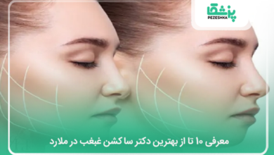بهترین دکتر ساکشن غبغب در ملارد