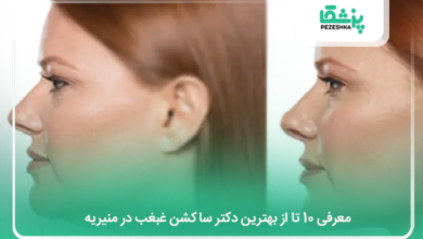 بهترین دکتر ساکشن غبغب در منیریه