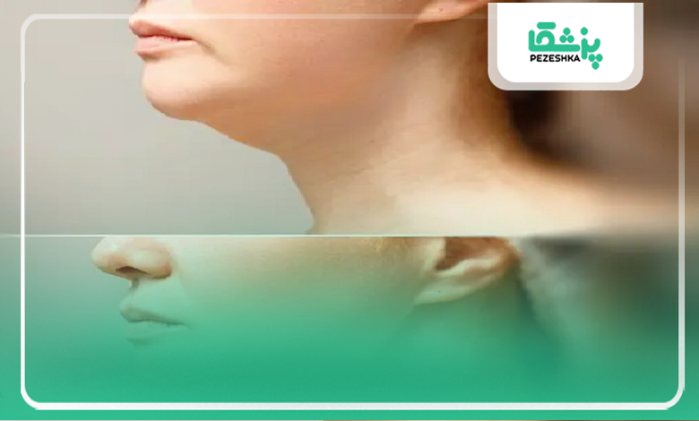 معیارهای تشخیصی بهترین دکتر ساکشن غبغب در منیریه