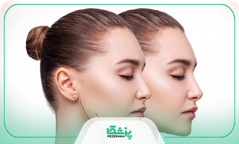 روشهای مختلف درمان غبغب
