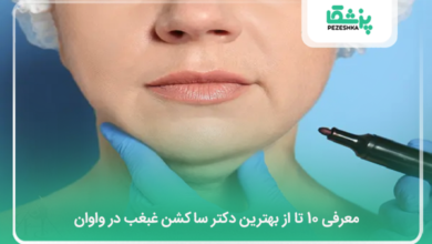 بهترین دکتر ساکشن غبغب در واوان