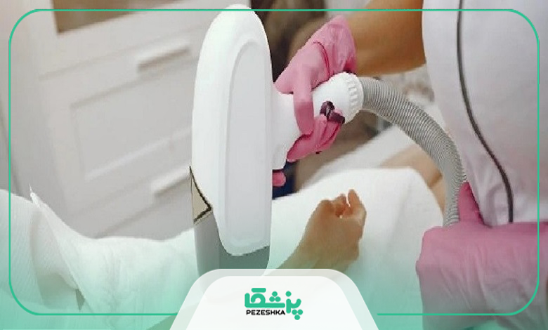 لیزر فول بادی برای چه قسمت هایی از بدن مفید است؟