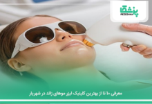 بهترین کلینیک لیزر موهای زائد در شهریار