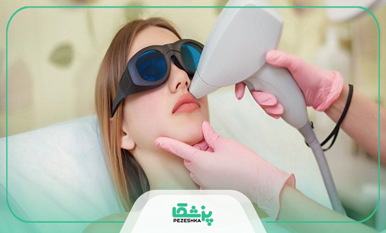 تفاوت لیزر با دستگاههای خانگی IPL