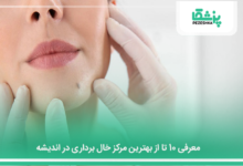بهترین مرکز خال برداری در اندیشه