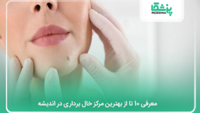 بهترین مرکز خال برداری در اندیشه