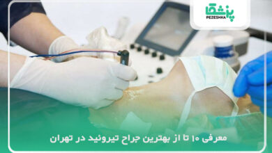 بهترین جراح تیروئید در تهران