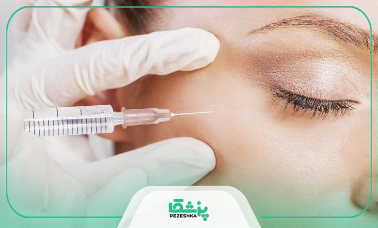 بوتاکس برای چه افرادی مناسب است؟