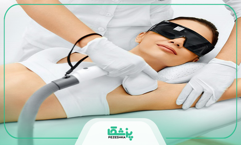 چه کسانی میتوانند لیزر فول بادی انجام دهند؟