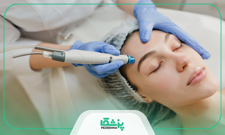 مزوتراپی برای چه کسانی مناسب است؟
