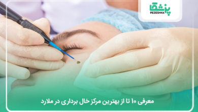 بهترین مرکز خال برداری در ملارد