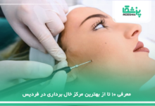 بهترین مرکز خال برداری در فردیس