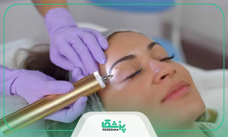 عوارض خال برداری و راههای پیشگیری