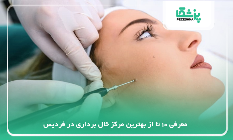 بهترین مرکز خال برداری در فردیس