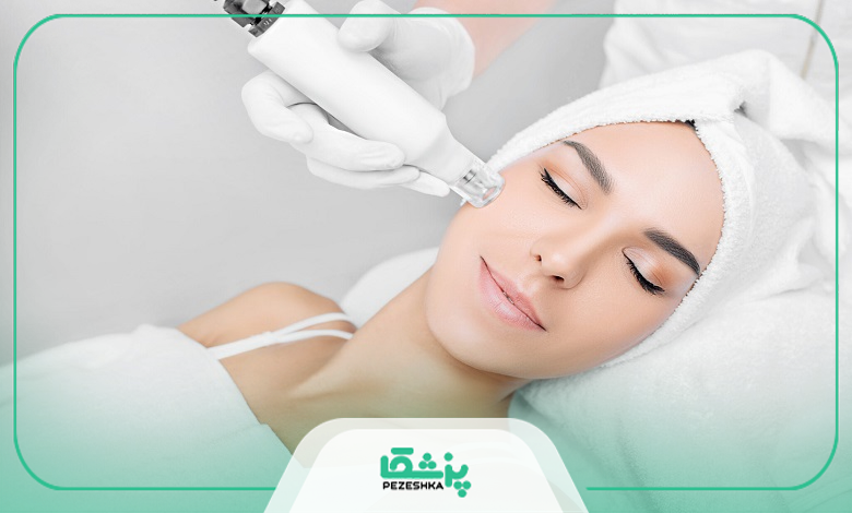 هایفوتراپی بهتر است یا اندولیفت؟