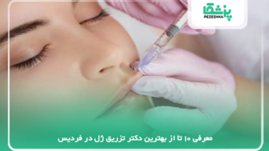 بهترین دکتر تزریق ژل در فردیس