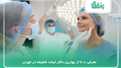بهترین دکتر لیفت شقیقه در تهران