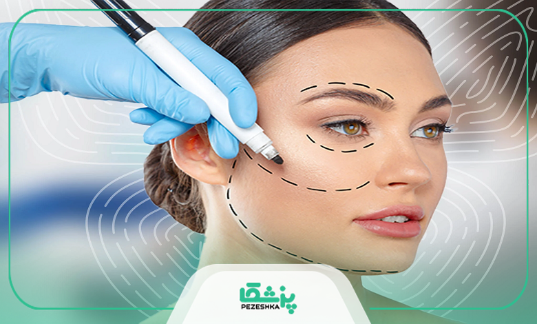 عوارض لیفت شقیقه که باید بدانید!