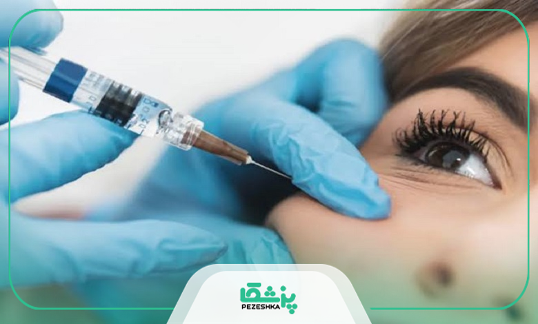 تزریق ژل چه عوارضی دارد؟ ۷ توصیه پزشکان قبل از تزریق ژل