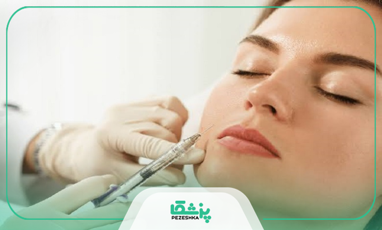 تزریق ژل برای چه کسانی مناسب است؟