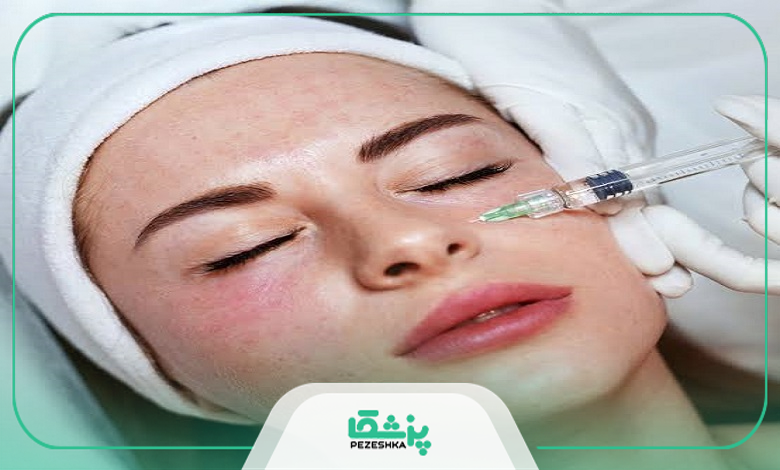 فواید و عوارض انجام مزوتراپی
