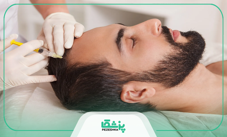 مزوتراپی چه مزایا و عوارضی دارد؟