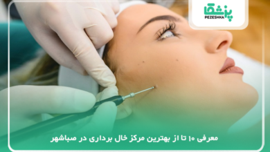 بهترین مرکز خال برداری در صباشهر