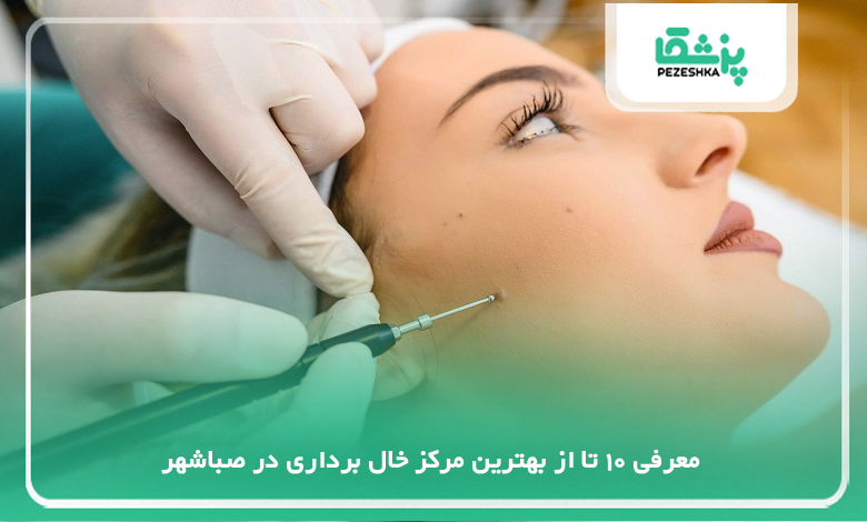 بهترین مرکز خال برداری در صباشهر