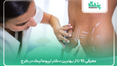 معرفی 10 تا از بهترین دکتر لیپوماتیک در کرج