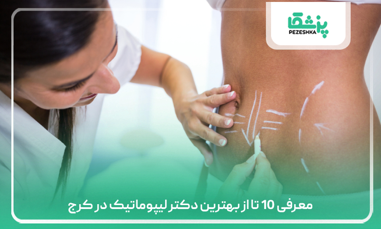 معرفی 10 تا از بهترین دکتر لیپوماتیک در کرج