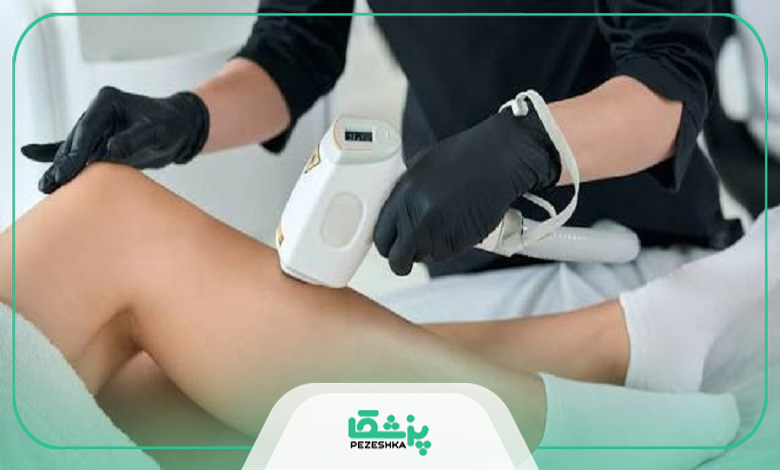 آیا لیزر فول بادی عوارض دارد؟