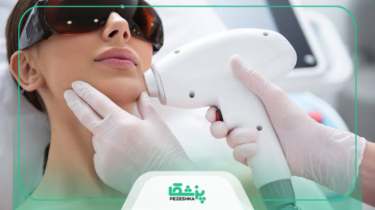 چه کسانی نباید لیزر موهای زائد انجام دهند؟