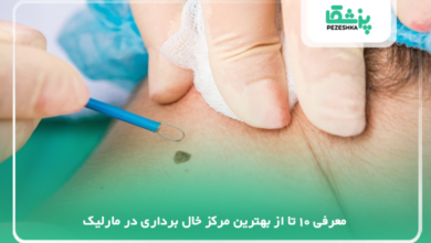 بهترین مرکز خال برداری در مارلیک