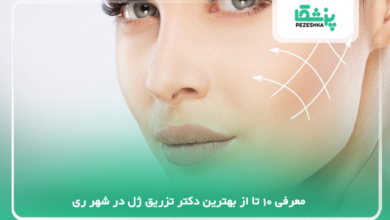 بهترین دکتر تزریق ژل در شهر ری