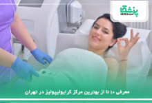 بهترین مرکز کرایولیپولیز در تهران
