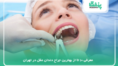 بهترین جراح دندان عقل در تهران