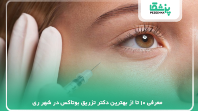 بهترین دکتر تزریق بوتاکس در شهر ری