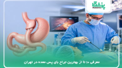 بهترین جراح بای پس معده در تهران