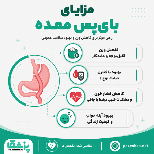 مزایای بای پس معده
