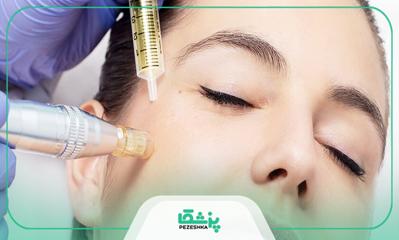 چه کسانی نباید مزوتراپی انجام دهند؟