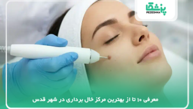 بهترین مرکز خال برداری در شهر قدس