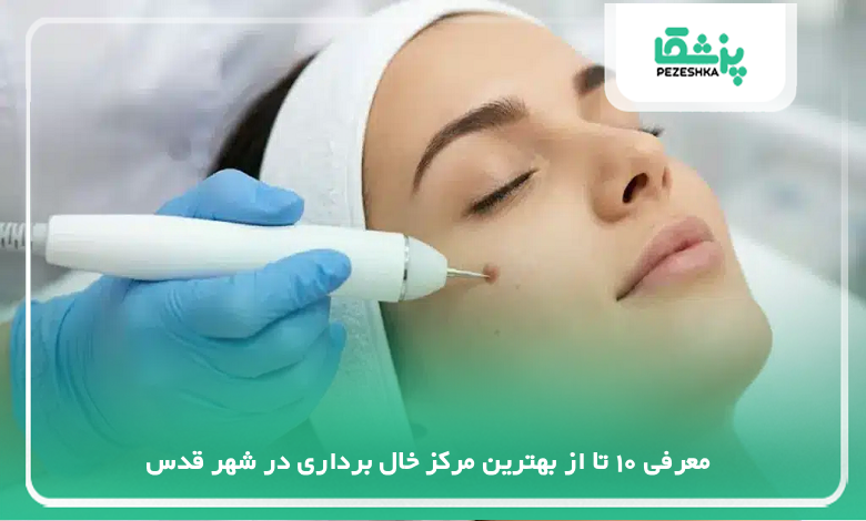 بهترین مرکز خال برداری در شهر قدس