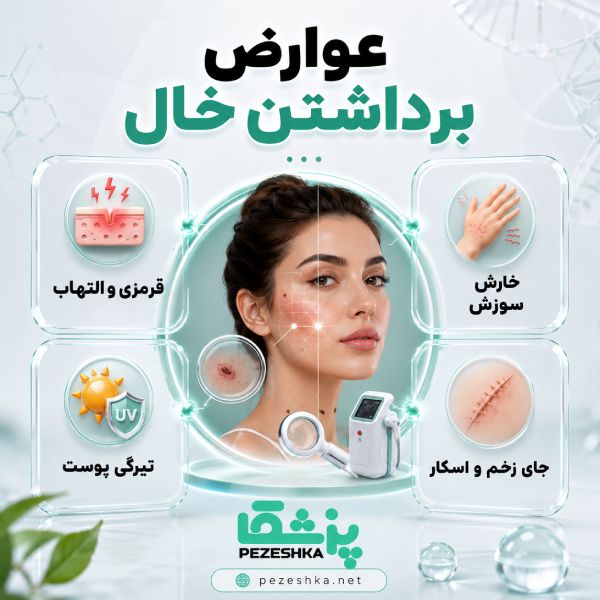خال را با لیزر برداریم یا جراحی؟