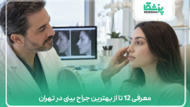 بهترین جراح بینی در تهران (لیست 12 جراح برتر +نمونه کار)