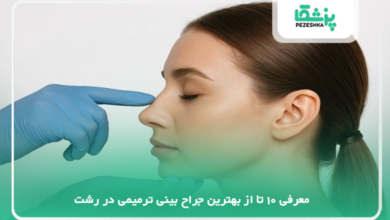 بهترین جراح بینی ترمیمی