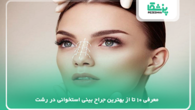 بهترین جراح بینی استخوانی در رشت