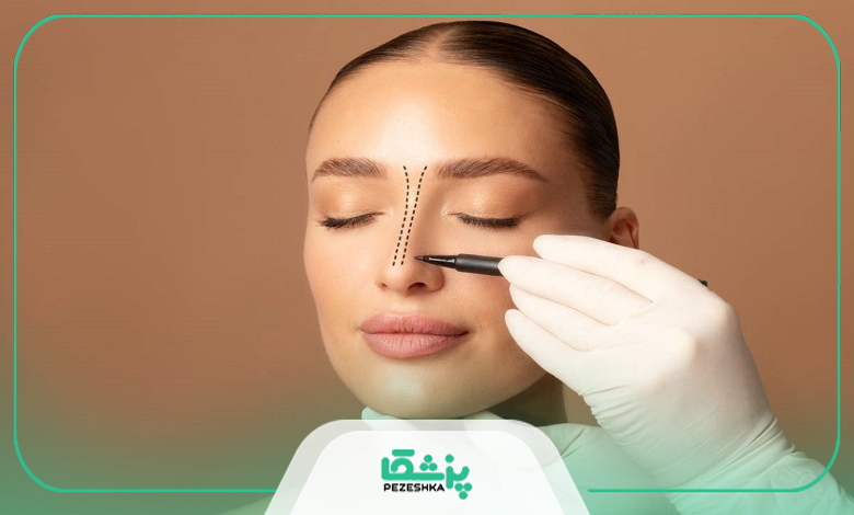 بهترین سن برای جراحی بینی گوشتی