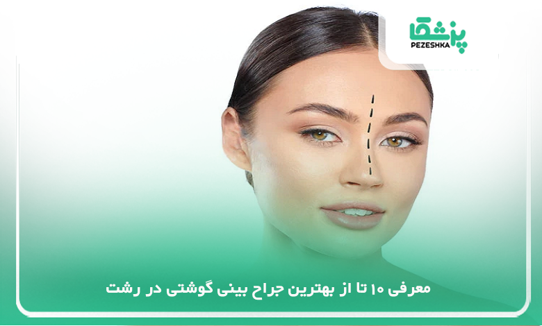 بهترین جراح بینی گوشتی در رشت